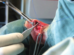 Musculo-Surgery-Ruptured Tendon