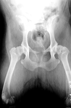 Musculo arthritis